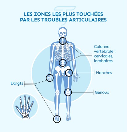 zones touchées par les troubles articulaires